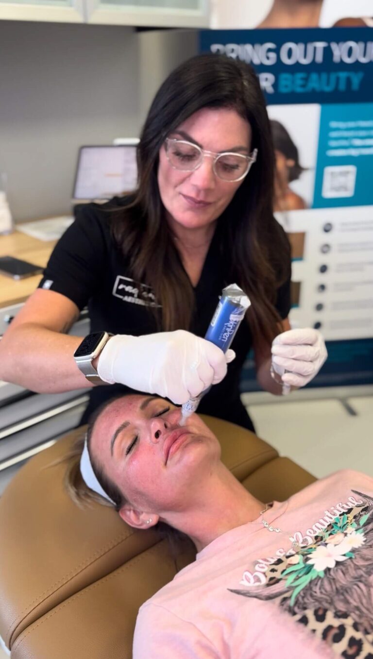 SkinPen Microneedling in Granbury
