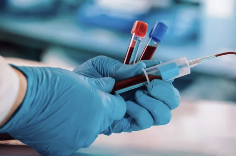 HRT Hormone replacement therapy
