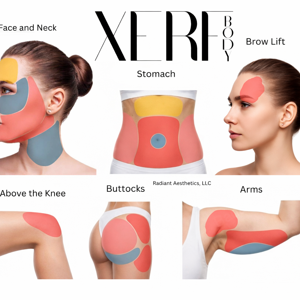 XERF body treatments offered at Radiant Aesthetics in hudson oaks, and granbury serving willow park, tolar, stephenville, peacoon plantation, Godly. Results you can see.