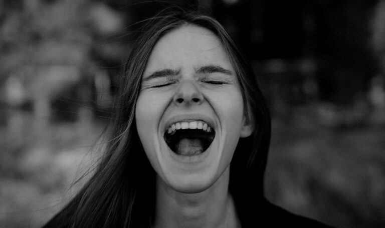 Woman able to open her mouth after TMJ TMJD treatment with dry needling